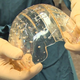 Illustration for article titled 3D Printing = Incredible Medical Breakthroughs